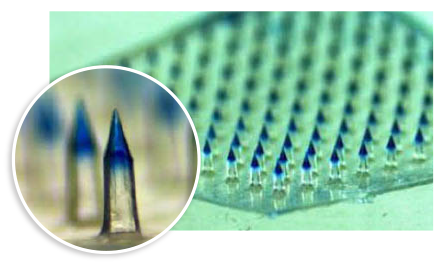 microneedle array